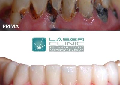 Dentista con laser Brescia
